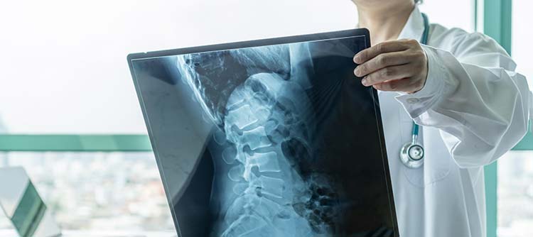 Spinal Cord Implantation Pre-Op Imaging