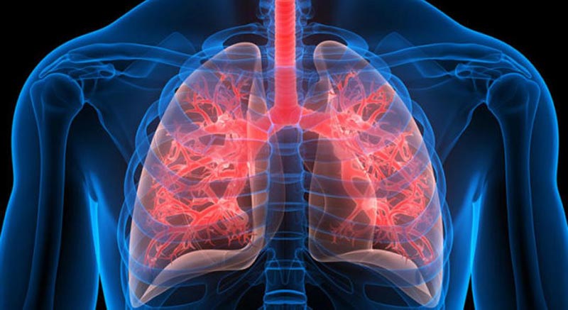 Respiratory Distress Due to Electrocution