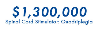 $1.3M Spinal Cord Stimulator Settlement