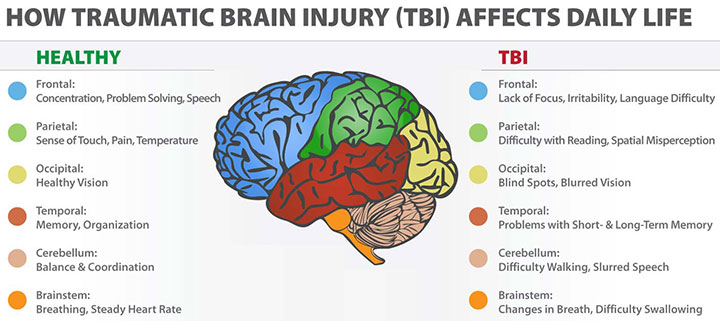 Truck Wreck TBI