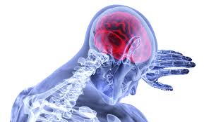 traumatic brain injury